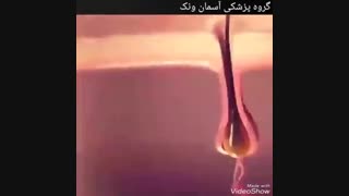 شیوه تاثیر لیزر بر فولیکول مو و ازبین بردن فولیکولهای موی در حال رشد