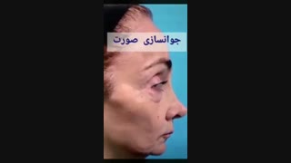 فیلم جوانسازی صورت