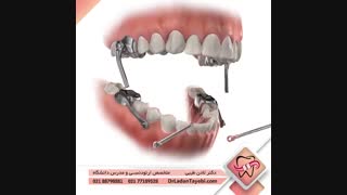 دستگاه هربست | دکتر لادن طیبی