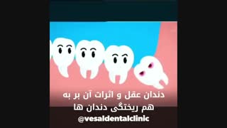 اثرات منفی دندان عقل