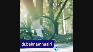 استقلال فرد پس از قطع عضو بدن