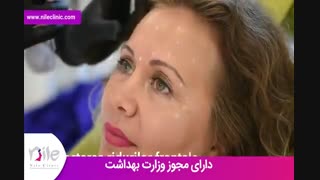 تزریق بوتاکس | فیلم تزریق بوتاکس | کلینیک پوست و مو نیل | شماره 24