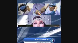 نمونه عمل بینی