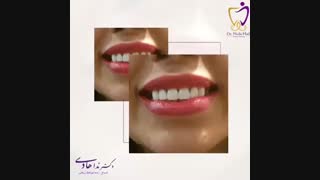 بهترین دندانپزشک زیبایی در تهران