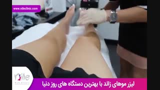 لیزر موهای زائد | فیلم لیزر موهای زائد | کلینیک پوست و مو نیل | شماره 20