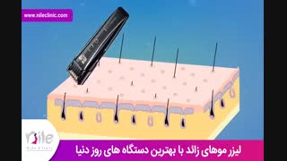لیزر موهای زائد | فیلم لیزر موهای زائد | کلینیک پوست و مو نیل | شماره 21