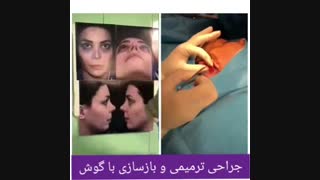بهترین جراح بینی ترمیمی در تهران