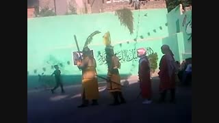 شهادت حر و فرزند حر سیاهبند سبحان زاهدی فرزند حر محمدرضا زاهدی حر جراحی پف زیر چشم