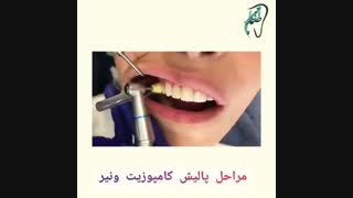 مراحل پالیش کامپوزیت ونیر
