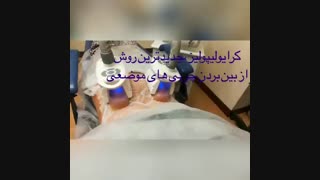 فیلم لاغری موضعی بدون جراحی با لیزر کرایولیپولیز