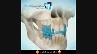 مراحل رشد دندان