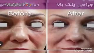 دکتر بهزاد سلیمى متخصص پوست مو زیبایی در بندر انزلی لیپوساکشن