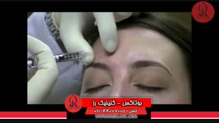 تزریق بوتاکس | فیلم تزریق بوتاکس | کلینیک پوست و مو رز | شماره 34
