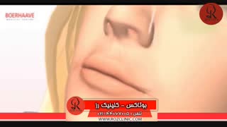 تزریق بوتاکس | فیلم تزریق بوتاکس | کلینیک پوست و مو رز | شماره 35