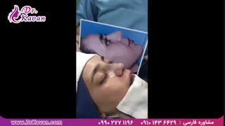 عمل زیبایی بینی