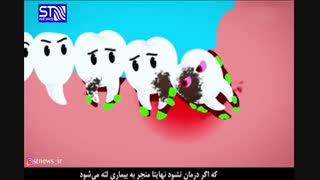 چه بر سر دندان عقل می آید؟