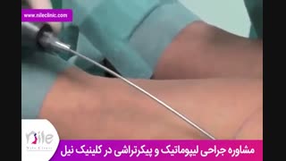 لیپوماتیک | فیلم لیپوماتیک | کلینیک پوست و مو نیل | شماره 25