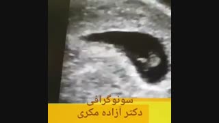 ❤️سونوگرافى جنین شش هفته و شش روز ❤️