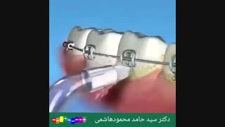 واترپیک یا نخ دندان کدام بهتر است؟