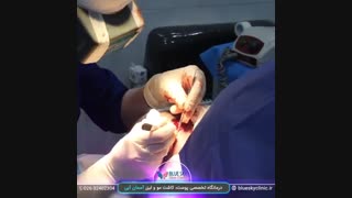 کاشت مو - 02632402304