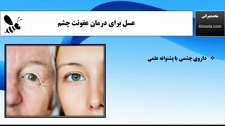 درمان عفونت چشم با عسل