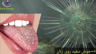 علائم سرطان,پیشگیری از سرطان و سیزده نشانه شروع سرطان را که باید جدی بگیرید