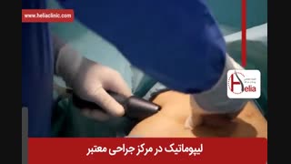 لیپوماتیک | فیلم لیپوماتیک | کلینیک پوست و مو هلیا | شماره 31