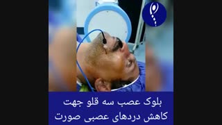 بلوک عصب سه قلو جهت کنترل دردهای عصبی صورت