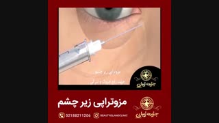 مزوتراپی زیر چشم