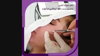 جوانسازی پوست با مزوتراپی صورت زاویه سازی صورت