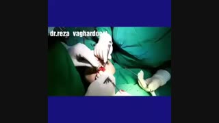 عورض جراحی بینی