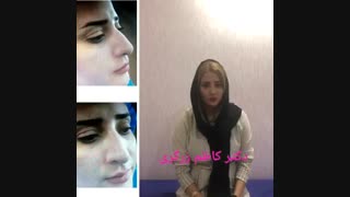 فیلم جراحی بینی - دکتر زرگری