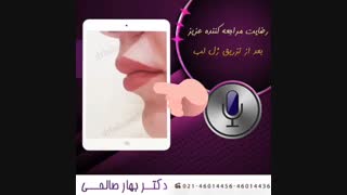 تزریق ژل لب