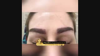 کاشت ابرو در عرفان نیایش