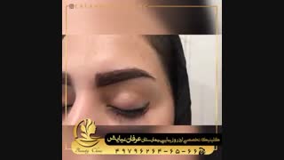 نمونه کاشت ابرو