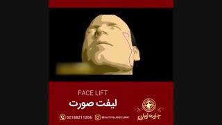 لیفت صورت به روایت تصویر