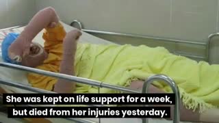 Free Discussion; The Blue Girl