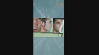 نمونه جراحی بینی مردانه