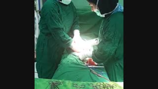 لحظه تولد نوزاد بدون سانسور