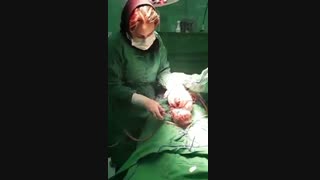 لحظه تولد نوزاد