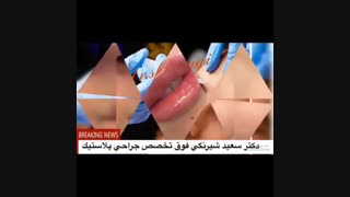 انواع جراحی زیبایی دکتر سعید شیرنگی
