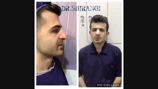 فیلم عمل بینی گوشتی بزرگ