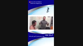 تزریق prpبرای درمان برخی از آسیب های مفصل شانه
