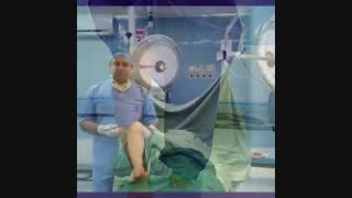 نتیجه عمل تعویض مفصل زانو