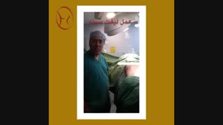 جراحی سینه همراه با جراحی شکم