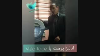 آنالیز پوست با دستگاه visio face