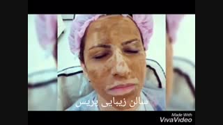 پاکسازی پوست در سالن زیبایی پریس دندان شیری