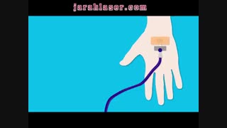 انواع آندوسکوپی و مراحل انجام و خطرات آن - کلینیک مهنا