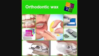 استفاده از موم‌های ارتودنسی