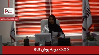 کاشت مو به روش sut | کلینیک هلیا | 02122819418